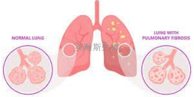 安徽专门做肺纤维化模型有哪家,肺纤维化模型