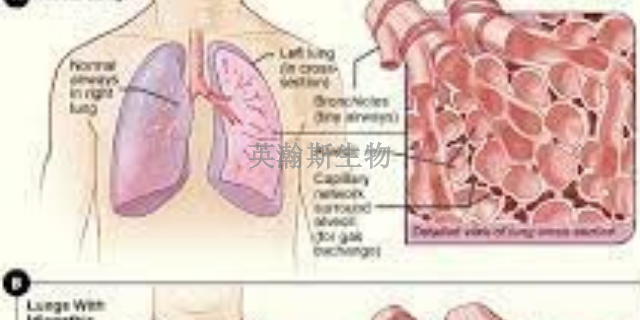 内蒙古靠谱的肺纤维化模型动物实验外包,肺纤维化模型