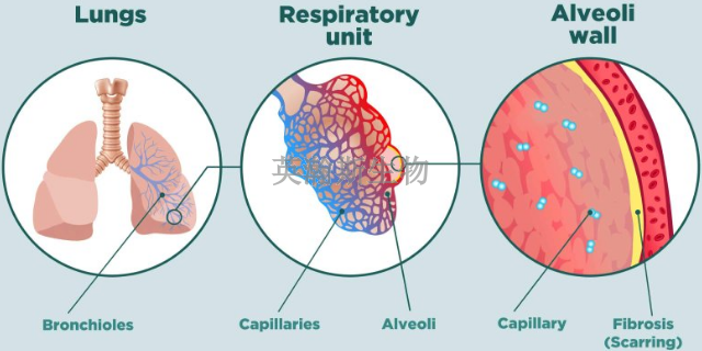 安徽专门做肺纤维化模型有哪家,肺纤维化模型