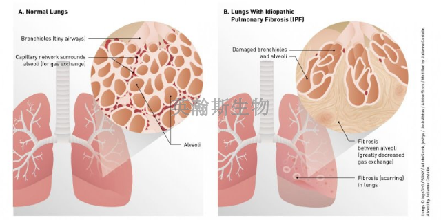 上海大鼠肺纤维化模型有哪家,肺纤维化模型